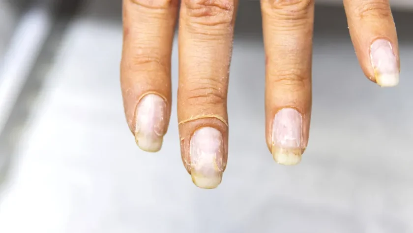 Uleiul de măsline, aliatul secret pentru cuticule uscate: tratamentul simplu de 5-10 minute care face minuni