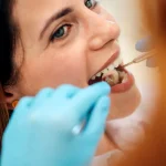 Zâmbetul perfect vs. sănătatea dentară: ce își doresc acum pacienții români