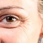 Ridurile, între semn al îmbătrânirii și povestea unei vieți trăite intens