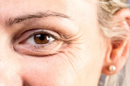 Ridurile, între semn al îmbătrânirii și povestea unei vieți trăite intens