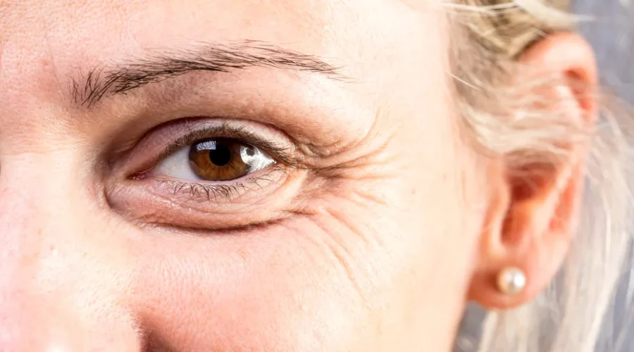 Ridurile, între semn al îmbătrânirii și povestea unei vieți trăite intens