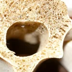 Ce se întâmplă cu oasele după 30 de ani. Obiceiurile care ajută la prevenirea osteoporozei