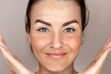 De ce apar petele pigmentare chiar dacă folosești zilnic SPF. Greșelile care pot reduce protecția pielii